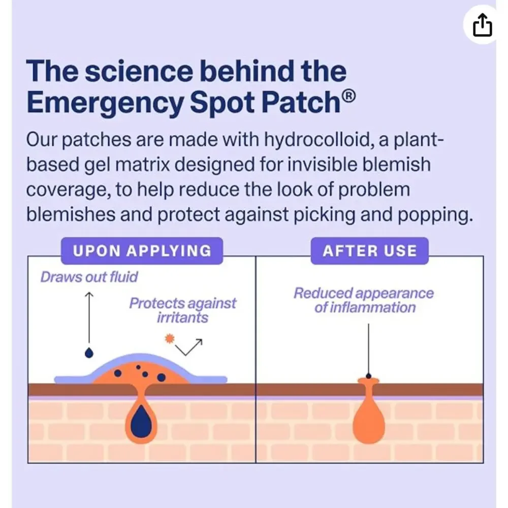 CUROLOGY | EMERGENCY SPOT PIMPLE PATCHES | 40 CT